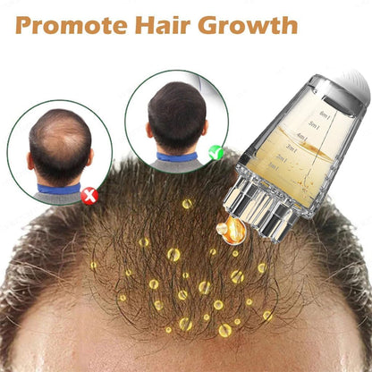 Estoy Hair Oil Applicator Comb, Smooth Root Comb Applicator Bottle For Scalp Oil, Anti Hair Loss Lotion Dispenser, Anti-Leak, 6Ml Scale Control, Salon Care, Oily/Greasy Hair (10ML)