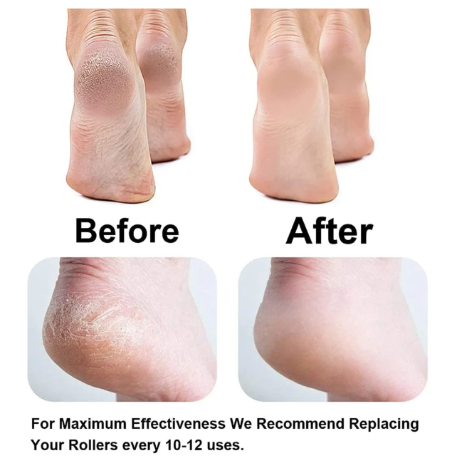 Estoy electric pedi roller for cracked heels dead skin hard foot callus remover women girl feet care tool foot scraper(1 pcs/multi color)