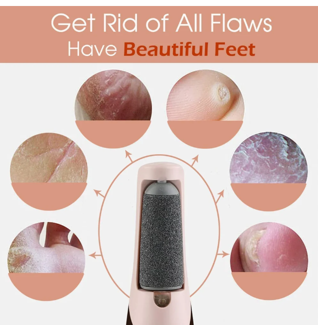 Estoy electric pedi roller for cracked heels dead skin hard foot callus remover women girl feet care tool foot scraper(1 pcs/multi color)
