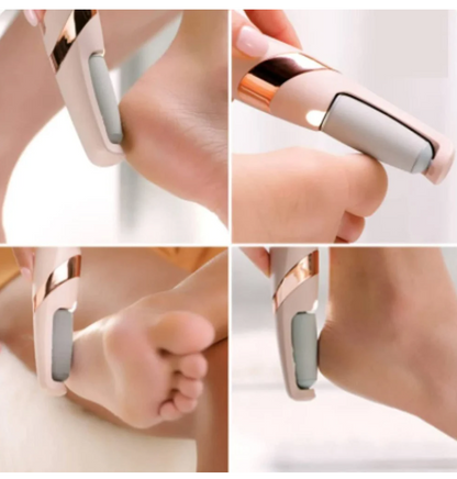Estoy electric pedi roller for cracked heels dead skin hard foot callus remover women girl feet care tool foot scraper(1 pcs/multi color)